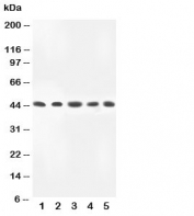 Western blot testing of MKK4 antibody and Lane 1:  rat skeletal muscle;  2: HeLa;  3: A549;  4: MM231;  5: CEM lysate.  Predicted molecular weight ~44 kDa.