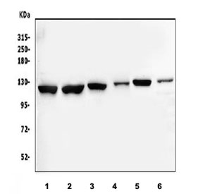 Western blot testing of 1) human HepG2, 2) human Jurkat, 3) human K562, 4