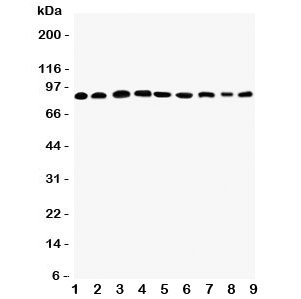Western blot testing of Plakophilin 2 antibody and Lane 1: rat heart; 2: human placenta; 3: (r) brain; 4: (r) intestine; 5: (h) HeLa; 6: (h) Jurkat; 7: (h) 293T; 8: (h) MCF-7; 9: (h) U87 lysate. Expected/observed size ~88KD