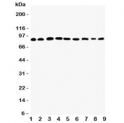 Western blot testing of Plakophilin 2 antibody and Lane 1:  rat heart;  2: human placenta;  3: (r) brain;  4: (r) intestine;  5: (h) HeLa;  6: (h) Jurkat;  7: (h) 293T;  8: (h) MCF-7;  9: (h) U87 lysate. Predicted molecular weight: 93-97 kDa.
