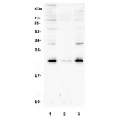 Western blot testing of human 1) Caco-2, 2) HepG2 and 3) A549 cell lysate with Rab8 antibody. Predicted molecular weight: ~24 kDa.
