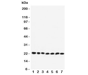 Western blot testing of Rab9 antibody and Lane 1: rat brain; 2: mouse brain; 3: human HeLa; 4: (r) PC12; 5: (m) NIH3T3; 6: (h) A431; 7: (h) 293T lysate. Expected/observed size ~23KD