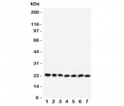 Western blot testing of RAB9 antibody and Lane 1:  rat brain;  2: mouse brain;  3: human HeLa;  4: (r) PC12;  5: (m) NIH3T3;  6: (h) A431;  7: (h) 293T lysate.  Expected/observed molecular weight: ~23 kDa.