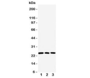 Western blot testing of RAB11A antibody and Lane 1:  human HeLa;  2: mouse NIH3T3;  3: human A431 lysate.  Expected molecular weight ~24 kDa.