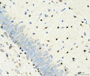IHC staining of FFPE rat brain tissue with SOX2 antibody. HIER: boil tissue sections in pH8 EDTA for 20 min and allow to cool before testing.