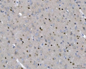 IHC staining of FFPE mouse brain tissue with SOX2 antibody. HIER: boil tissue sections in pH8 EDTA for 20 min and allow to cool before testing.