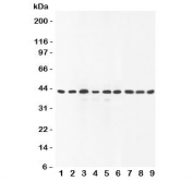 Western blot testing of SOX7 antibody and Lane 1:  rat brain;  2: human placenta;  3: (r) lung;  4: (r) testis;  5: (h) HeLa;  6: (h) A549;  7: (h) HEPG2;  8: (h) SMMC-7721;  9: mouse Neuro-2a lysate