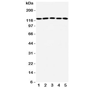 Western blot testing of ST5 antibody and Lane 1: rat testis; 2: human A431; 3: (h) HeLa; 4: (h) COLO320; 5: mouse NIH3T3 lysate