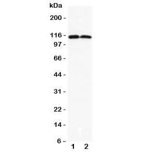 Western blot testing of DOG1 antibody and Lane 1: rat liver; 2: rat skeletal muscle lysate. Expected/observed size 114~130KD depending on glycosylation level.