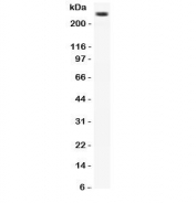 Western blot testing of CACNA1D antibody and rat brain lysate.  Expected molecular weight: ~245 kDa.