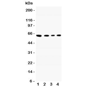 Western blot testing of CADM1 antibody and Lane 1: A549; 2: Jurkat; 3: Raji; 4: HeLa lysate. Expected/observed size ~60KD