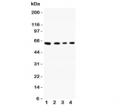Western blot testing of CADM1 antibody and Lane 1:  A549;  2: Jurkat;  3: Raji;  4: HeLa lysate.  Predicted molecular weight: ~48/37kDa (isoforms 1/2) with N-linked and O-linked glycosylation each possibly adding ~25kDa to the observed size.