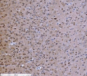 IHC staining of FFPE mouse brain tissue with PSD-95 antibody. HIER: boil tissue sections in pH8 EDTA for 20 min and allow to cool before testing.