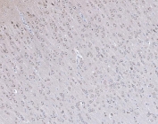 IHC staining of FFPE rat brain tissue with PSD-95 antibody. HIER: boil tissue sections in pH8 EDTA for 20 min and allow to cool before testing.