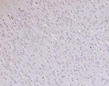 IHC staining of FFPE rat brain tissue with PSD-95 antibody. HIER: boil tissue sections in pH8 EDTA for 20 min and allow to cool before testing.