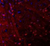 Immunofluorescent staining of FFPE rat brain tissue with PSD-95 antibody (red) and DAPI nuclear stain (blue). HIER: steam section in pH6 citrate buffer for 20 min.