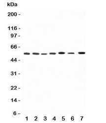 Western blot testing of Kv1.1 antibody and Lane 1: rat brain; 2: (r) testis; 3: (r) heart; 4: human HeLa; 5: (h) U87; 6: (h) SHG-44; 7: mouse Neuro-2a lysate
