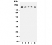 Western blot testing of MUC1 antibody and Lane 1:  COLO320;  2: SW620;  3: HEPG2;  4: MCF-7;  5: Jurkat lysate;  This glycoprotein is commonly visualized between 120~500 kDa.
