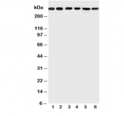 Western blot testing of Mucin-5AC antibody and Lane 1:  SGC;  2: HeLa;  3: COLO320;  4: SW620;  5: MCF-7;  6: PANC lysate; Predicted size: ~500KD, Observed size: 300KD+