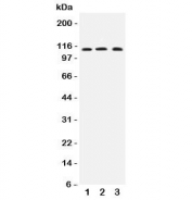 Western blot testing of human 1) COLO320, 2) MCF-7 and 3) PANC lysate with TRPC4 antibody at 0.5ug/ml.  Predicted molecular weight: ~112 kDa.