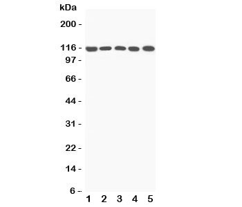 Western blot testing of C5a antibody and Lane 1: rat liver; 2: mouse liver; 3: (m) NIH3T3; 4: (m) HEPA; 5: (r) PC12 lysate; Predicted/Observed size: 115KD