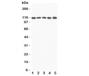 Western blot testing of C5A antibody and Lane 1:  rat liver;  2: mouse liver;  3: (m) NIH3T3;  4: (m) HEPA1-6;  5: (r) PC12 lysate;  Predicted molecular weight ~115 kDa.