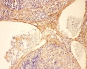 IHC-P: C5A antibody testing of rat spleen tissue