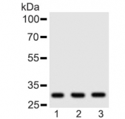 Western blot testing of human 1) placenta, 2) HeLa and 3) Jurkat lysate with Adiponectin antibody at 0.5ug/ml. Predicted molecular weight ~30 kDa.