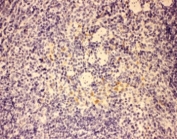 IHC-P: GMCSF antibody testing of mouse spleen tissue. HIER: steamed with pH6 citrate buffer.