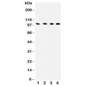 Western blot testing of ICAM-1 antibody and human samples 1: HEPG2; 2: K562; 3: A549; 4: HT1080 lysate. The glycoprotein is routinely visualized at 75~115KD.