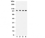 Western blot testing of ICAM-1 antibody and human samples 1:  HEPG2;  2: K562;  3: A549;  4: HT1080 lysate.  Predicted molecular weight: ~58/75-115kDa (unmodified/glycosylated).