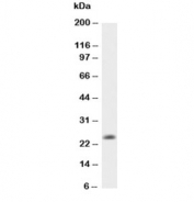 Western blot testing of IL-6 antibody (0.5ug/ml) and recombinant rat protein (0.5ng)