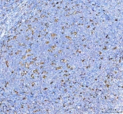 IHC staining of FFPE human tonsil tissue with IL-18 antibody. HIER: boil tissue sections in pH8 EDTA for 20 min and allow to cool before testing.
