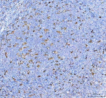 IHC-P: IL-18 antibody testing of human tonsil tissue. HIER: steamed with pH6 citrate buffer.