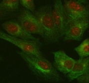 Immunofluorescent staining of FFPE human A549 cells with IL-18 antibody (red) and Beta Tubulin mAb (green). HIER: steam section in pH6 citrate buffer for 20 min.