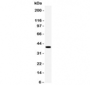 Western blot testing of ITGB4 antibody and recombinant human protein (0.5ng).