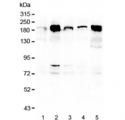 Western blot testing of human 1) A549, 2) PC-3, 3) T-47D, 4) HeLa and 5) Caco-2 cell lysate with ITGB4 antibody at 0.5ug/ml. Predicted molecular weight ~200 kDa.