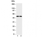 Western blot testing of p53 antibody (0.5ug/ml) and Lane 1:  HEPG2;  2: COLO320 lysate