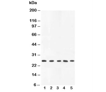 Western blot testing of TNFa antibody and rat samples: 1. PC-12, 2. spleen, 3. brain, 4. kidney, 5. liver lysate. Predicted/observed molecular weight: ~26kDa.