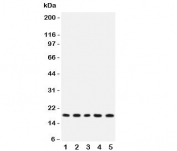 Western blot testing of IL-2 antibody and rat samples 1:  thymus;  2: liver;  3: NRK;  4: PC12;  5: RH35 lysate. Predicted molecular weight: 14-18kDa.