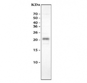 Western blot testing of mouse spleen tissue lysate with IL-18 antibody. Predicted molecular weight: 17~24 kDa.
