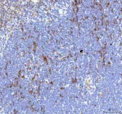 IHC staining of FFPE mouse spleen tissue with IL-18 antibody. HIER: boil tissue sections in pH8 EDTA for 20 min and allow to cool before testing.