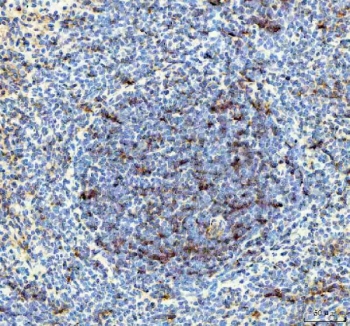 IHC staining of FFPE rat spleen with IL-18 antibody. HIER: boil tissue sections in pH8 EDTA for 20 min and allow to cool before testing.