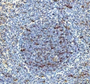 IHC staining of FFPE rat spleen tissue with IL-18 antibody. HIER: boil tissue sections in pH8 EDTA for 20 min and allow to cool before testing.