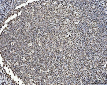 IHC staining of FFPE human tonsil tissue with BRCA1 antibody. HIER: boil tissue sections in pH8 EDTA for 20 min and allow to cool before testing.