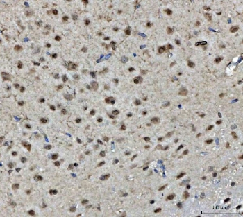 IHC staining of FFPE rat brain tissue with BRCA1 antibody. HIER: boil tissue sections in pH8 EDTA for 20 min and allow to cool before testing.
