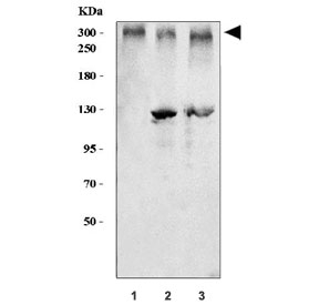 Western blot testing of human 1) HeLa, 2) T-47D and 3) Raji cell lysate with BRCA1 antibody. Predicted molecular weight ~207 kDa, commonly observed at 207-220 kDa.