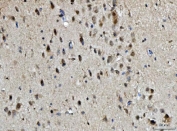 IHC staining of FFPE mouse brain tissue with BRCA1 antibody. HIER: boil tissue sections in pH8 EDTA for 20 min and allow to cool before testing.