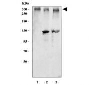 Western blot testing of human 1) HeLa, 2) T-47D and 3) Raji cell lysate with BRCA1 antibody. Predicted molecular weight ~207 kDa.