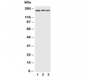 Western blot testing of EGFR antibody and human lysates 1:  HeLa;  2: A549;  3: A431 lysate. Expected molecular weight: ~134/170 kDa .(unmodified/glycosylated).